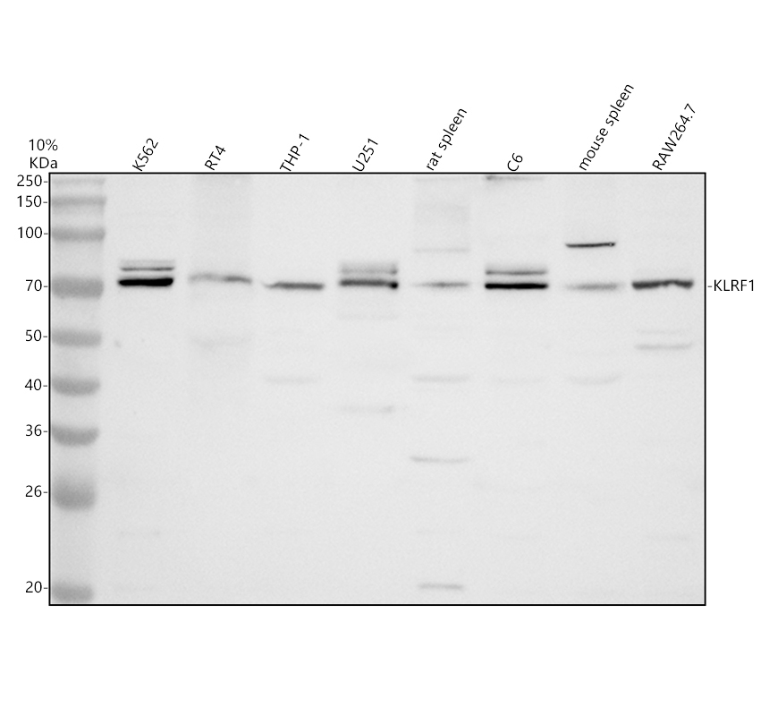 Western blot analysis of KLRF1 using anti-KLRF1 antibody (A09753-1)