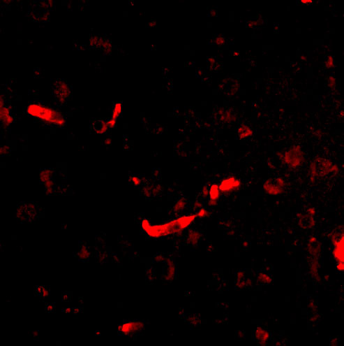 Immunofluorescence of SAPAP2 in Human Brain cells with SAPAP2 antibody at 20 μg/mL