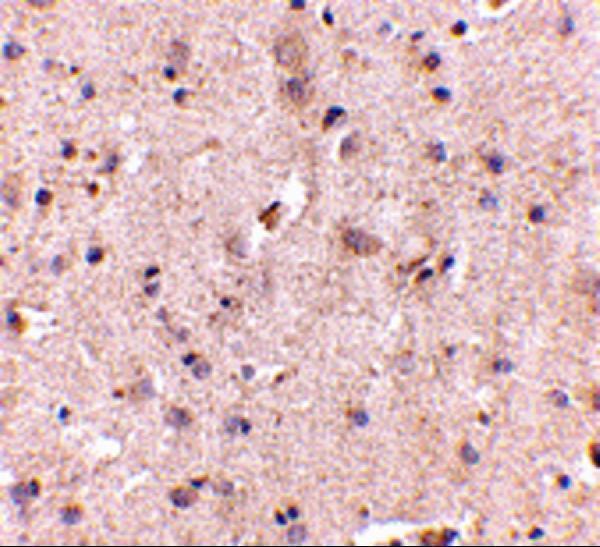 Immunohistochemistry of SAPAP2 in human brain with SAPAP2 antibody at 5 μg/mL