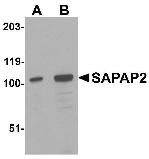 Western blot analysis of SAPAP2 in Raji cell lysate with SAPAP2 antibody at (A) 0