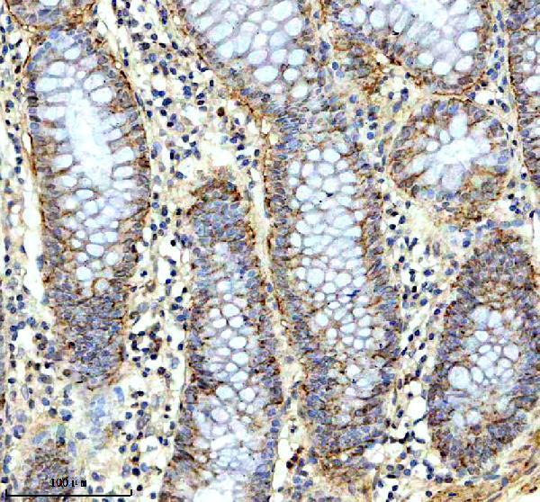 a09761 1 fibcd1 primary antibodies ihc testing 1