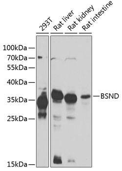 Western blot analysis of extracts of various cell lines, using BSND antibody  at 1:1000 dilution