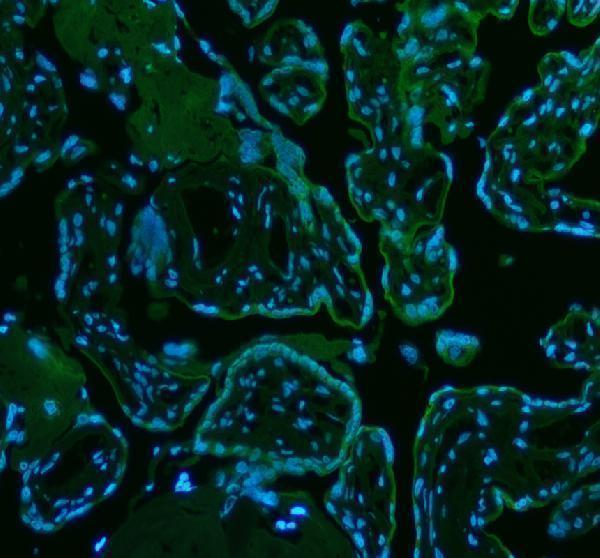 a09767 1 micall1 primary antibodies if testing 1