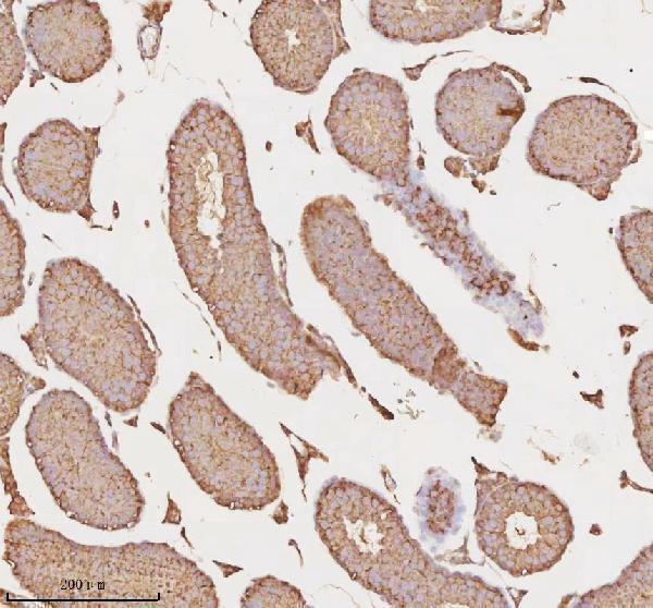 a09767 1 micall1 primary antibodies ihc testing 10