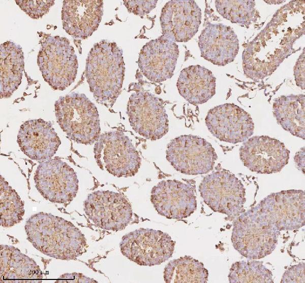 a09767 1 micall1 primary antibodies ihc testing 12