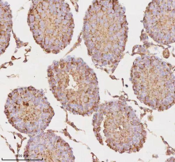 a09767 1 micall1 primary antibodies ihc testing 13_1
