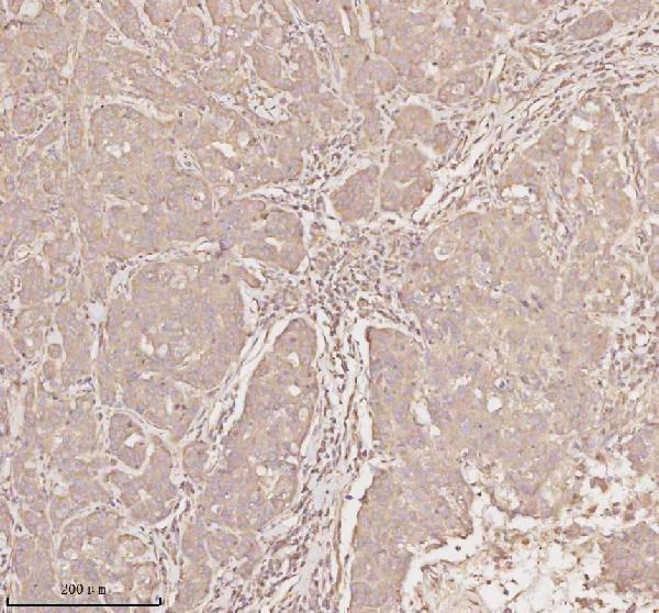  IHC analysis of MICALL1 using anti-MICALL1 antibody (A09767-1)