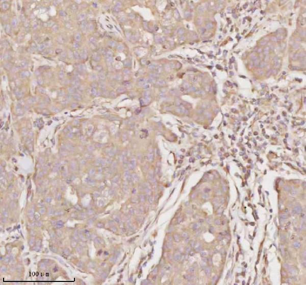  IHC analysis of MICALL1 using anti-MICALL1 antibody (A09767-1)