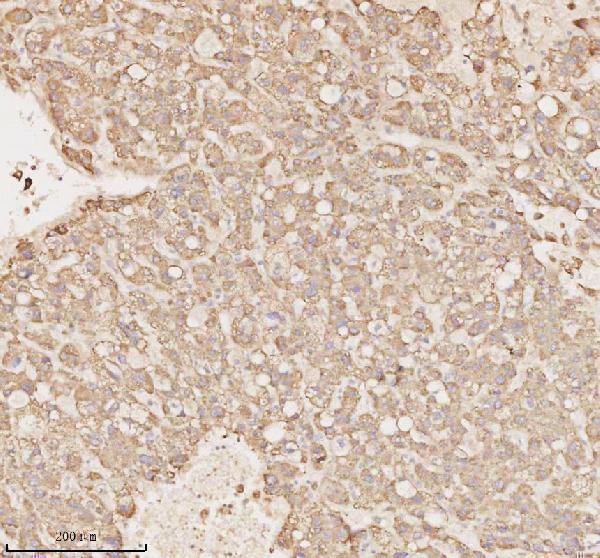 a09767 1 micall1 primary antibodies ihc testing 4_1