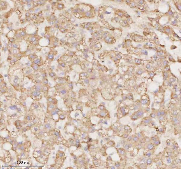 a09767 1 micall1 primary antibodies ihc testing 5_1