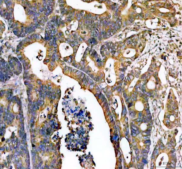 IHC analysis of DCBLD2 using anti-DCBLD2 antibody (A09768)