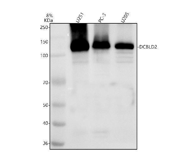 Western blot analysis of DCBLD2 using anti-DCBLD2 antibody (A09768)