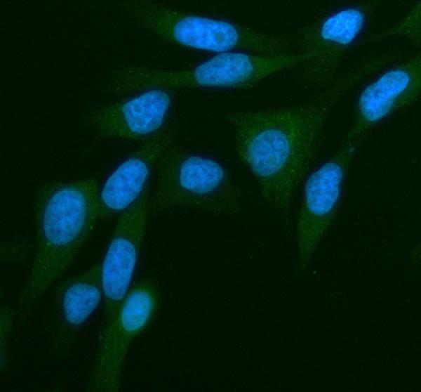  IF analysis of PKN3 using anti-PKN3 antibody (A09775-1)