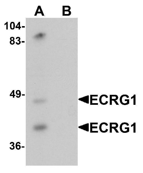a09776 tmprss11a primary antibodies wb testing 1