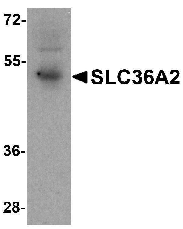 a09777 slc36a2 primary antibodies wb testing 1