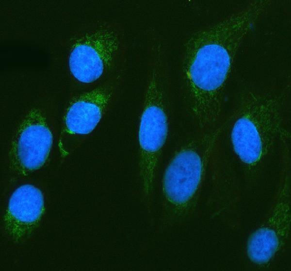  IF analysis of Calpain 6/CAPN6 using anti-Calpain 6/CAPN6 antibody (A09778-1)