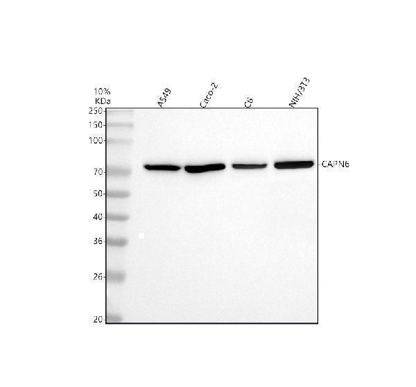  Western blot analysis of Calpain 6/CAPN6 using anti-Calpain 6/CAPN6 antibody (A09778-1)