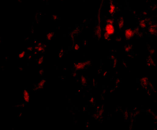Immunofluorescence of CAPN6 in Human Lung cells with CAPN6 antibody at 20 μg/mL