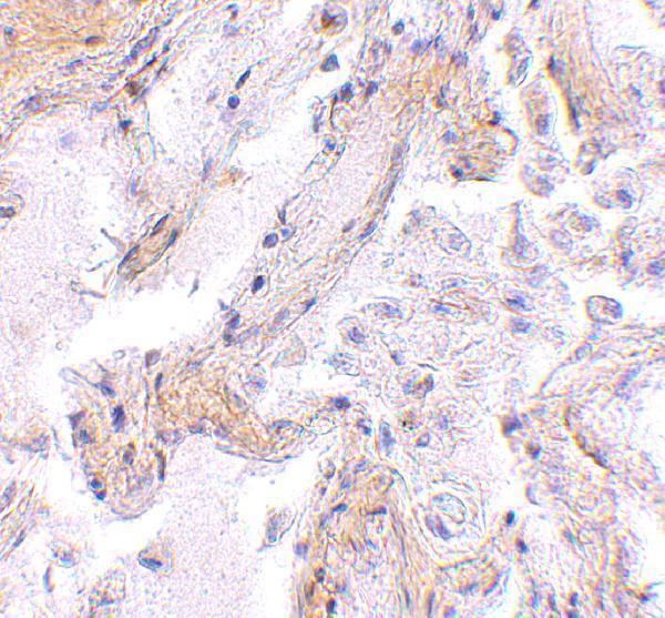Immunohistochemistry of CAPN6 in human lung tissue with CAPN6 antibody at 2
