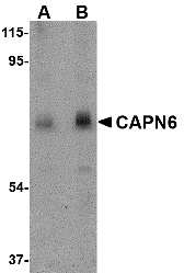 Western blot analysis of CAPN6 in rat lung tissue lysate with CAPN6 antibody at (A) 0
