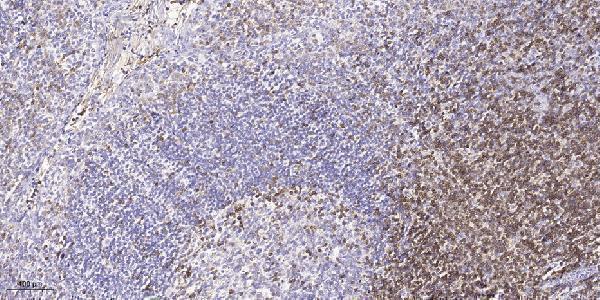 a09780 map3k13 primary antibodies ihc testing 1