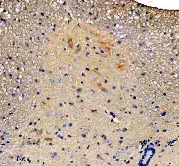 IHC analysis of SLC25A27 using anti-SLC25A27 antibody (A09782-2)