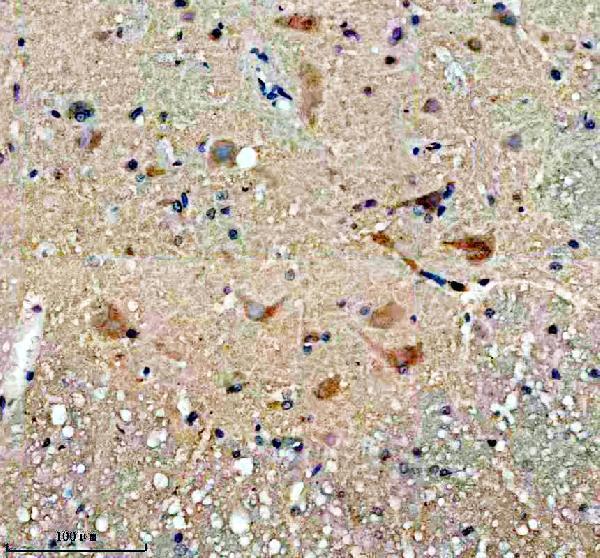 IHC analysis of SLC25A27 using anti-SLC25A27 antibody (A09782-2)