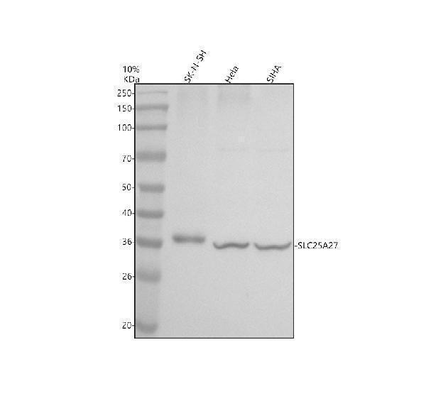Western blot analysis of SLC25A27 using anti-SLC25A27 antibody (A09782-2)
