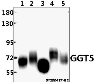 Western blot (WB) analysis of GGT5 pAb at 1:500 dilution
Lane1:H460 whole cell lysate(40ug)
Lane2:LO2 whole cell lysate(40ug)
Lane3:The renal tissue lysate of Mouse(40ug)
Lane4:MCF-7 whole cell lysate(40ug)
Lane5:HUT78 whole cell lysate(40ug)