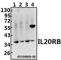a09784 1 il20rb primary antiboties wb testing 1
