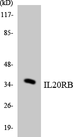 Western blot analysis of the lysates from COLO205 cells using IL20RB antibody