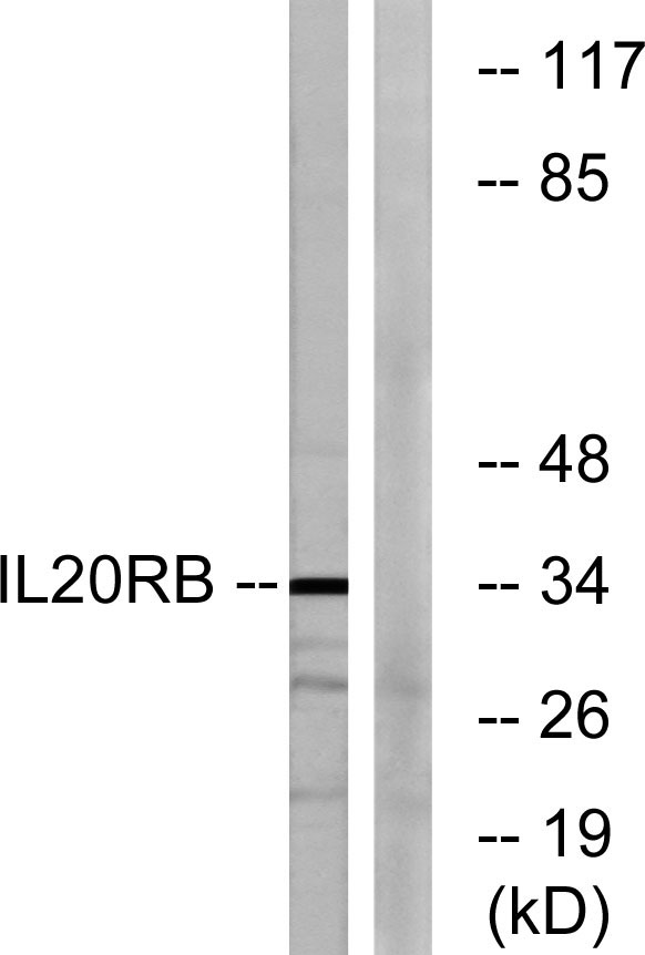 Western blot analysis of lysates from HeLa cells, using IL20RB Antibody