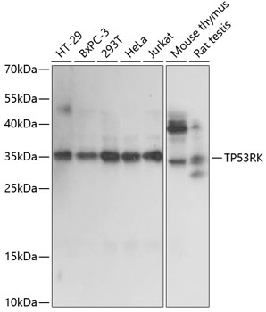 a09786 tp53rk primary antiboties wb testing 1