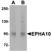 Western blot analysis of EphA10 in 293 cell lysate with EphA10 antibody at (A) 1 μg/mL and (B) 2 μg/mL