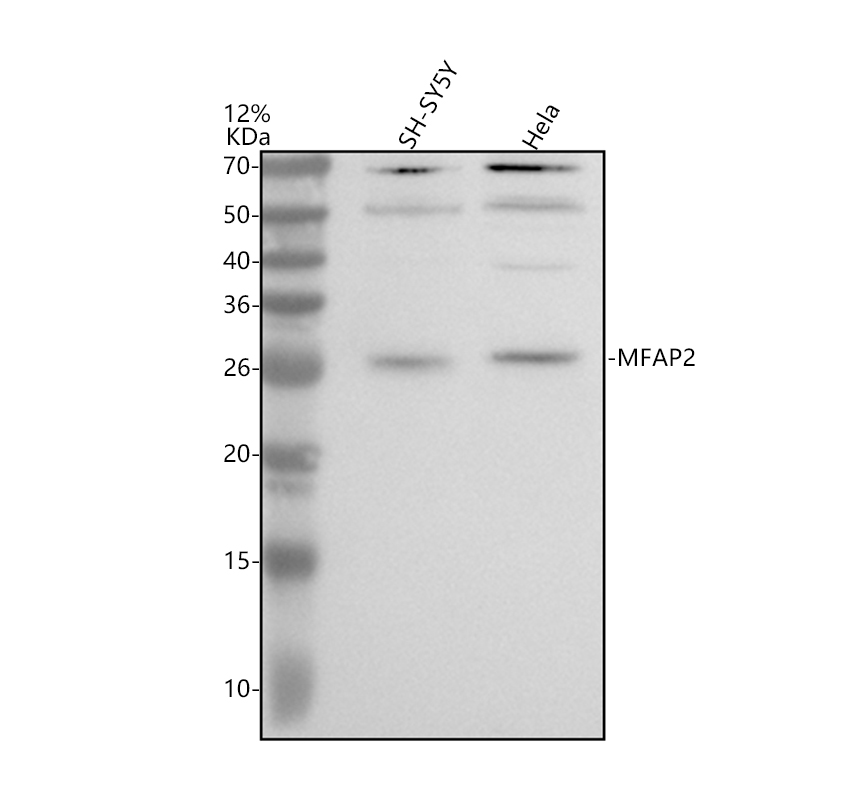 Western blot analysis of MFAP2 using anti-MFAP2 antibody (A09790-1)