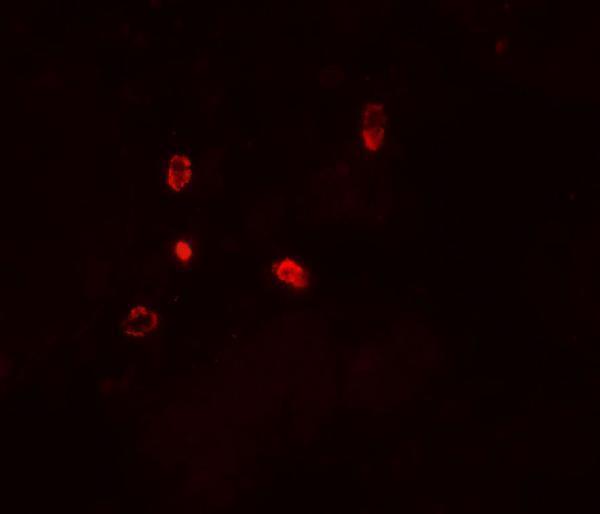 Immunofluorescence of ATG4D in human testis tissue with ATG4D antibody at 20 μg/ml
