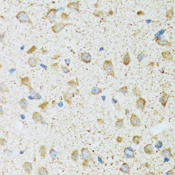 a09800 cog2 primary antiboties ihc testing 2