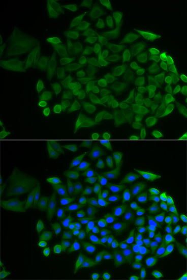 a09800 cog2 primary antiboties ihc testing 3