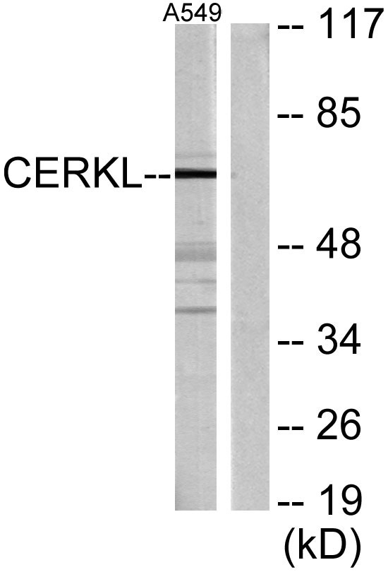 Western blot analysis of lysates from A549 cells, using CERKL Antibody