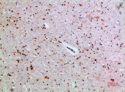 Immunohistochemical analysis of paraffin-embedded human-brain, antibody was diluted at 1:200