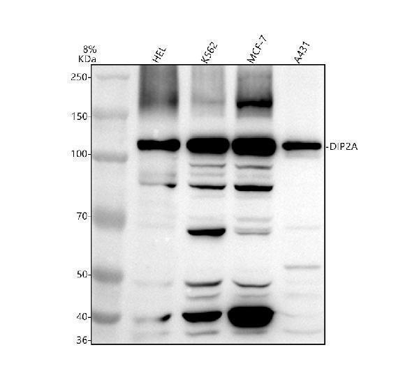 Western blot analysis of DIP2A using anti-DIP2A antibody (A09803-1)
