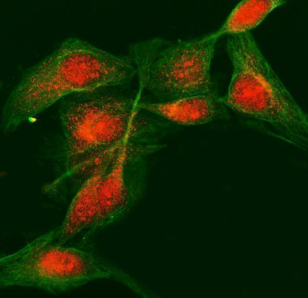 a09804 2 ldoc1 primary antibodies if testing 2