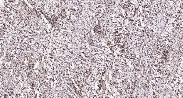 a09804 ldoc1 primary antibodies ihc testing 1