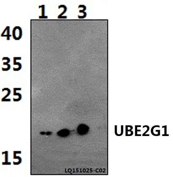a09806 ube2g1 primary antiboties wb testing 1