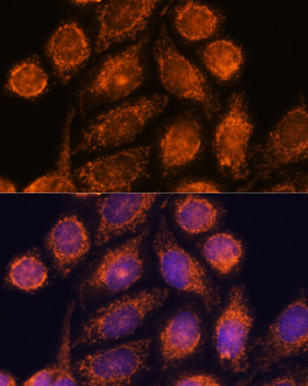 Immunofluorescence analysis of HeLa cells using MTMR9 antibody  at dilution of 1:100