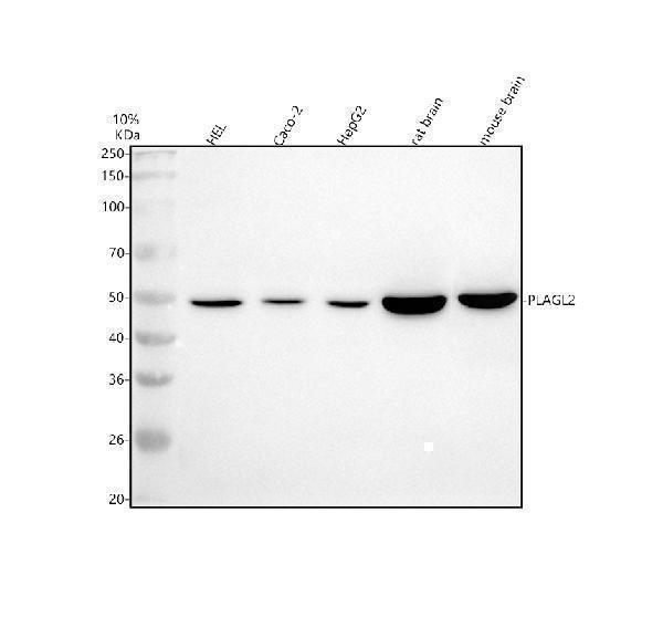 a09816 1 plagl2 primary antibodies wb testing 1