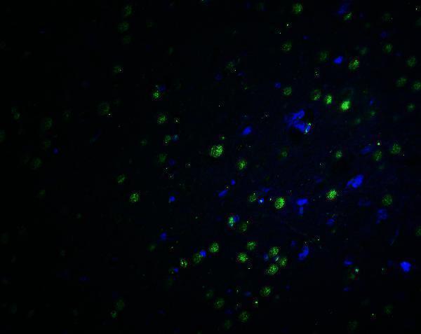a09816 plagl2 primary antibodies if testing 3