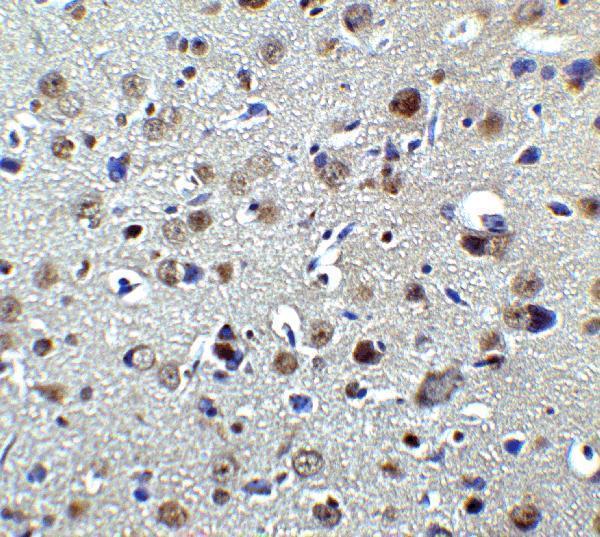 a09816 plagl2 primary antibodies ihc testing 2
