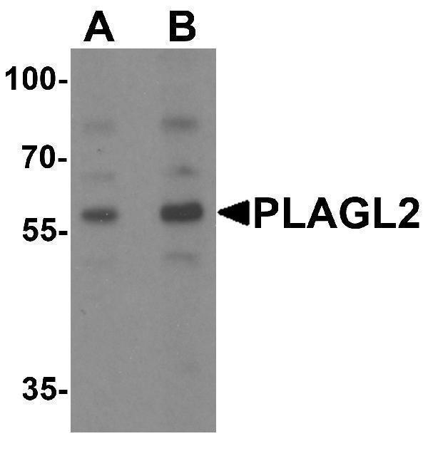 a09816 plagl2 primary antibodies wb testing 1
