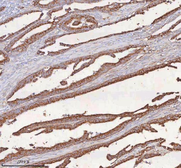 a09824 1 slc6a20 primary antibodies ihc testing 10